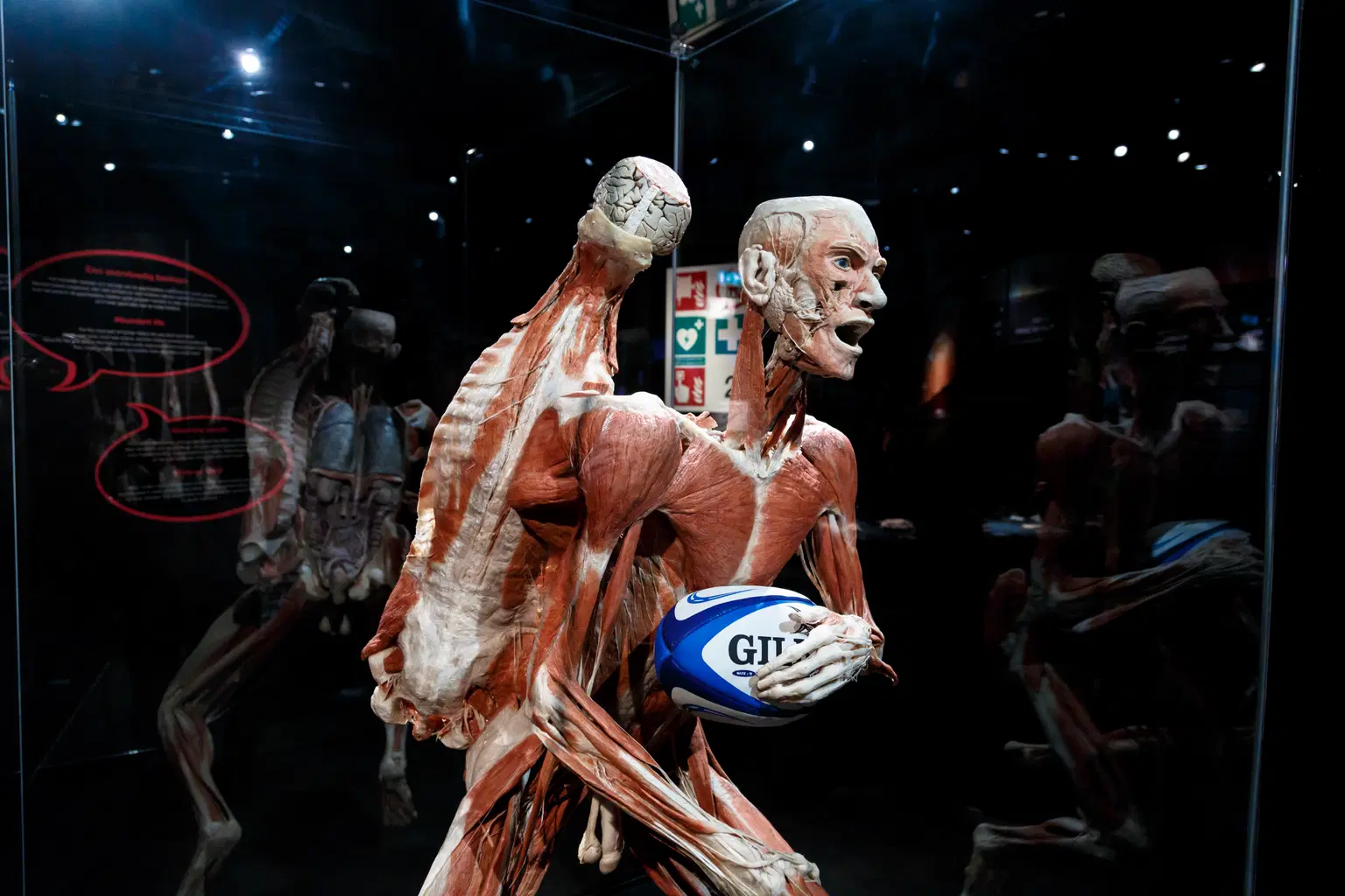 Body Worlds Museum