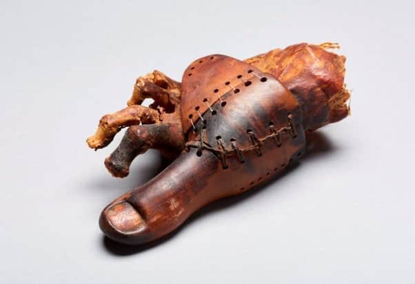 Gaze upon Tabaketenmut's prosthetic toe