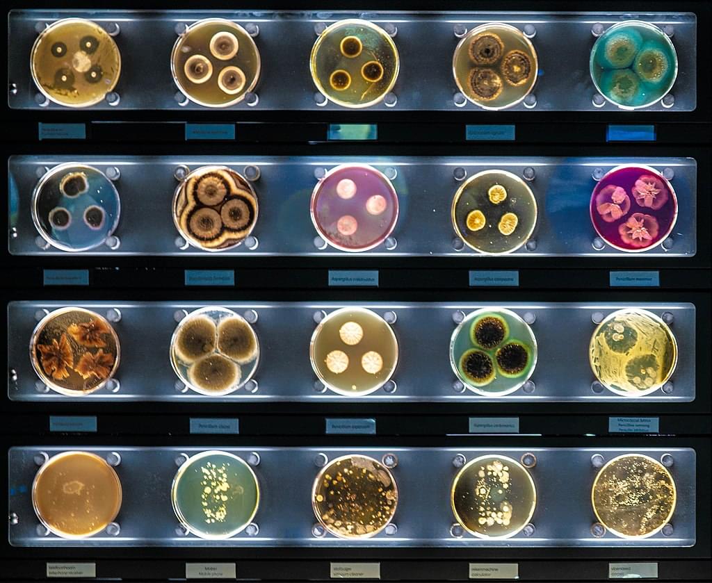See fantastic displays of microbes at Micropia